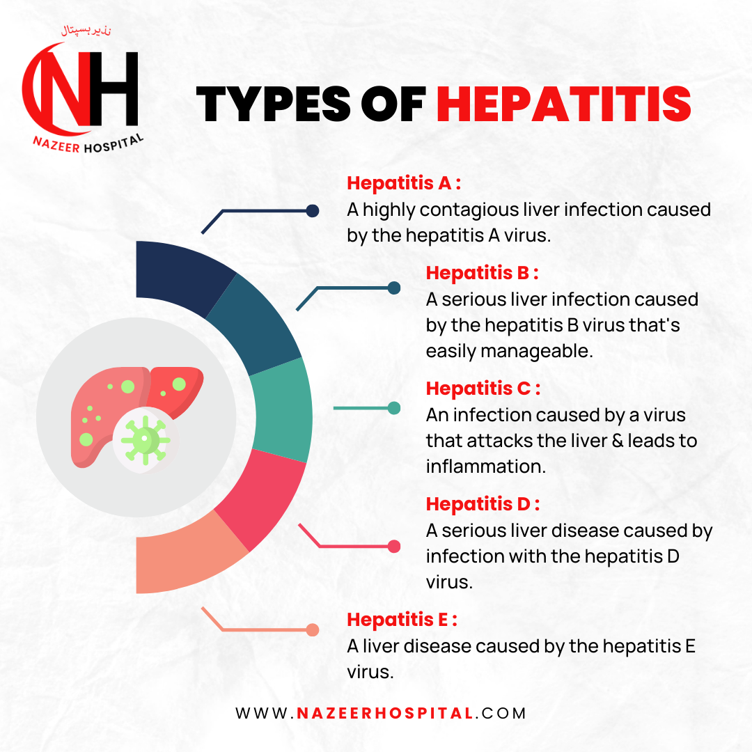 hepatitis Treatment in Pakistan - Nazeer Hospital